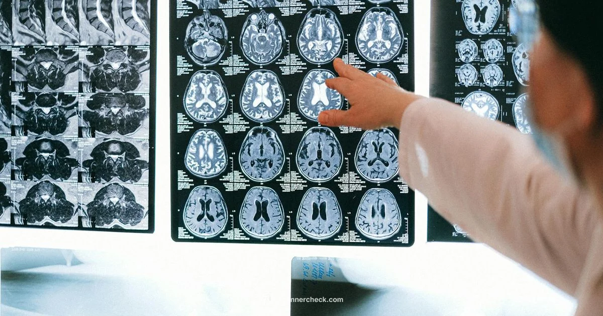 MRI Scan Guide MRI Scan Guide - Scanner Check