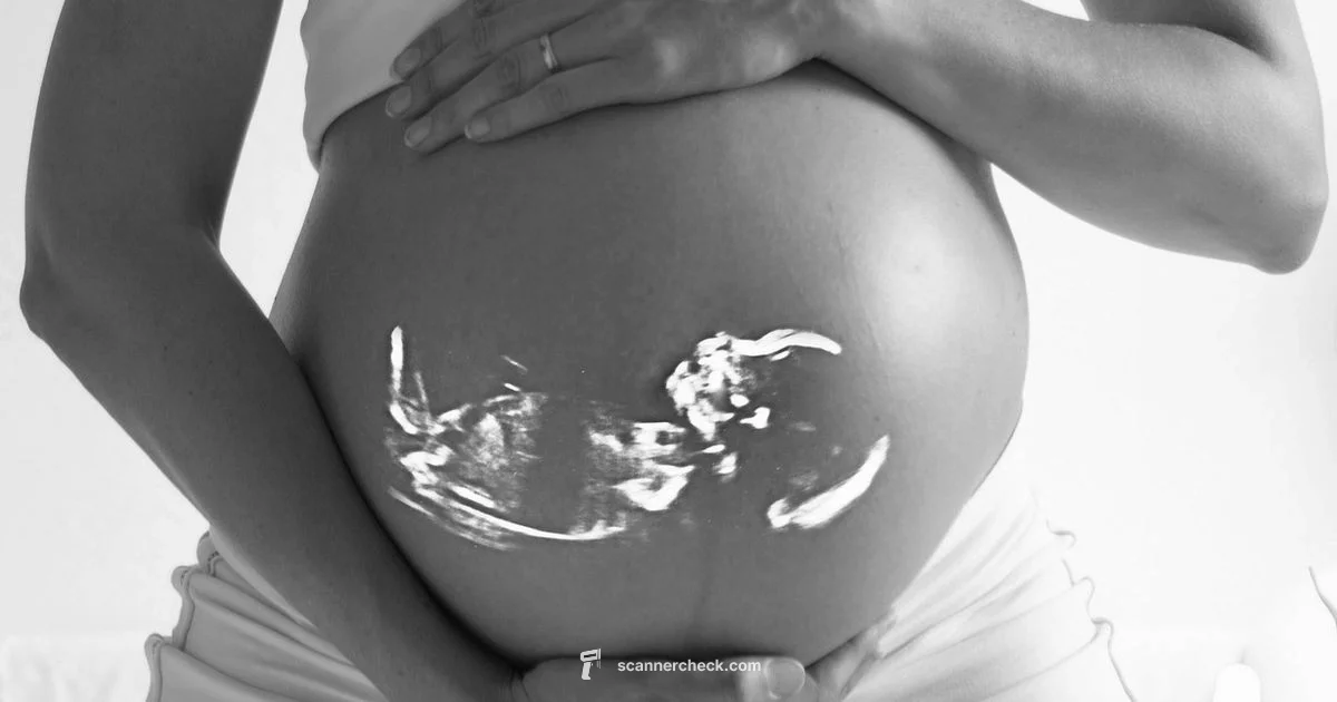 19-Week Anatomy Scan - Scanner Check