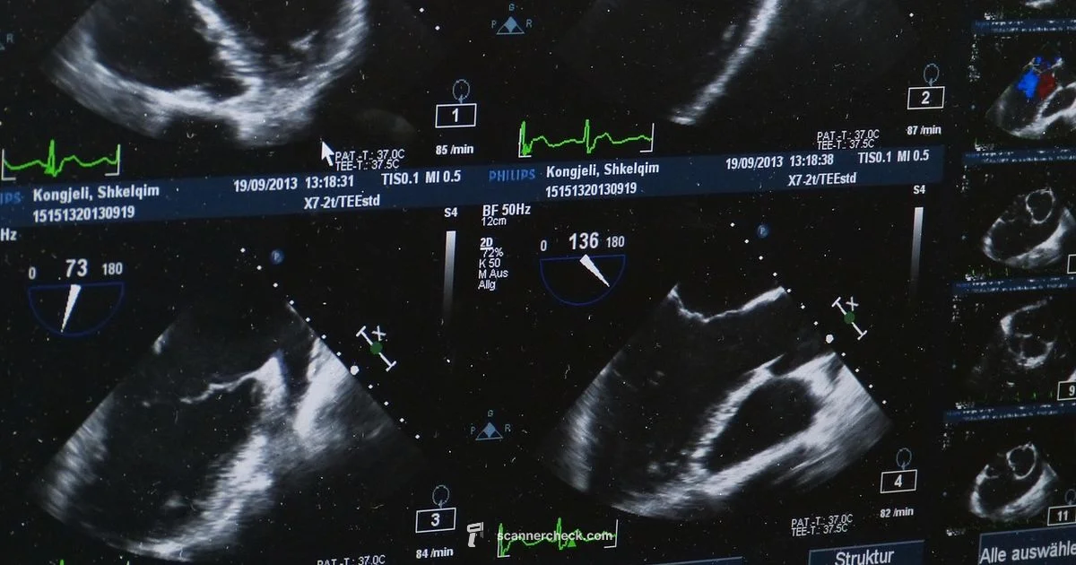 Gallbladder Scan Guide - Scanner Check