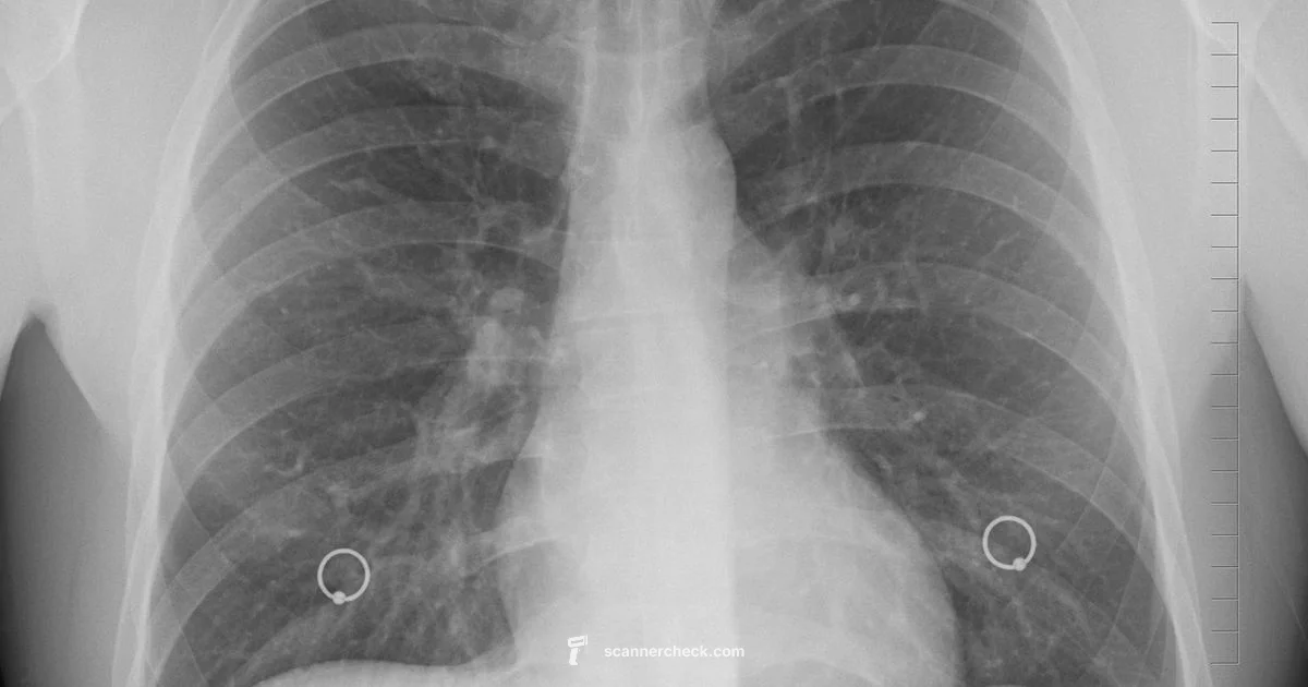 X-ray vs Scan Guide - Scanner Check