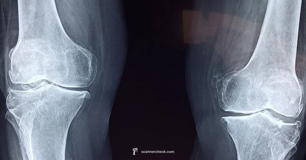 Bone Density Scanner - Scanner Check